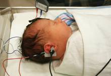 Figure B: an infant during an ABR procedure, a testing instrument on the right side of the head