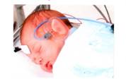 Figure C: an infant during an ABR procedure, a testing instrument on the left side of the head