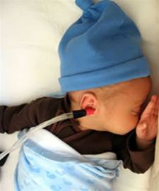 Figure E: an infant during tympanometry, a testing instrument in the left ear