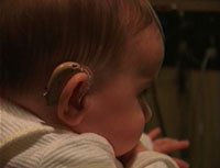 profile view of a baby wearing a hearing aid